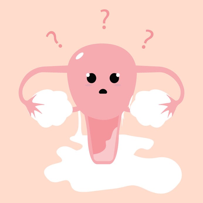 Imagem em desenho do útero com corrimento vaginal da cor branca