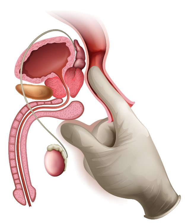 dedo dentro do canal da próstata para representar o orgasmo masculino